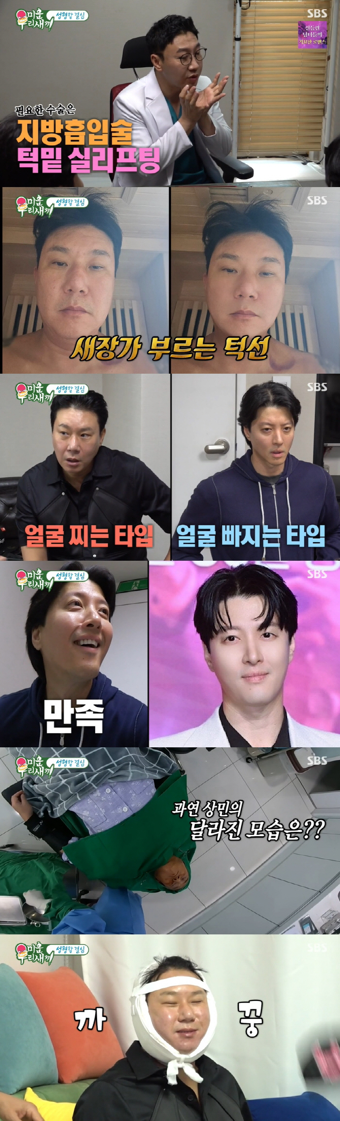 이상민, 턱밑 지방흡입..퉁퉁 부은 얼굴 "턱살 때문에 호흡 불편했다" …