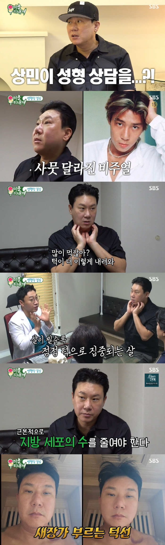이상민 "턱살 때문에 호흡 불편" 지방흡입 받았다..퉁퉁 부은 얼굴 ('…