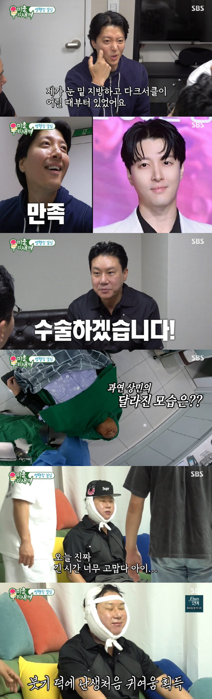 이상민 "턱살 때문에 호흡 불편" 지방흡입 받았다..퉁퉁 부은 얼굴 ('…