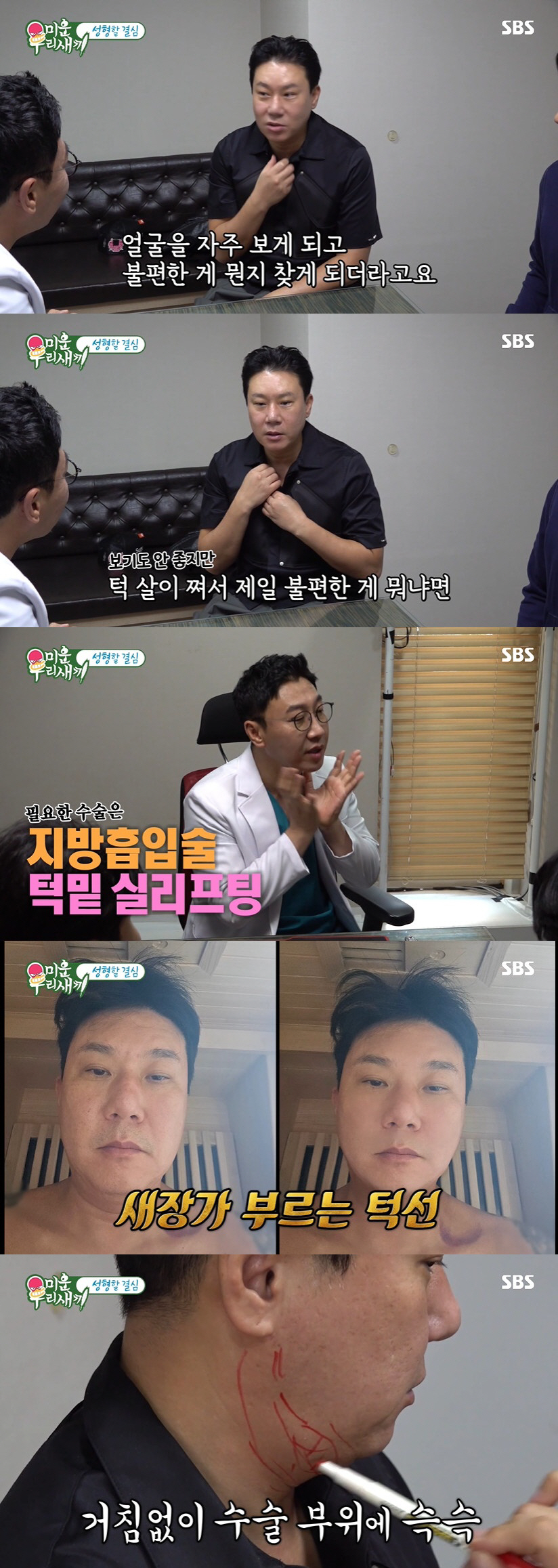 이상민, 턱 성형했다 "빚 청산 후 외모 보게 돼, 불편함 多" ('미우…