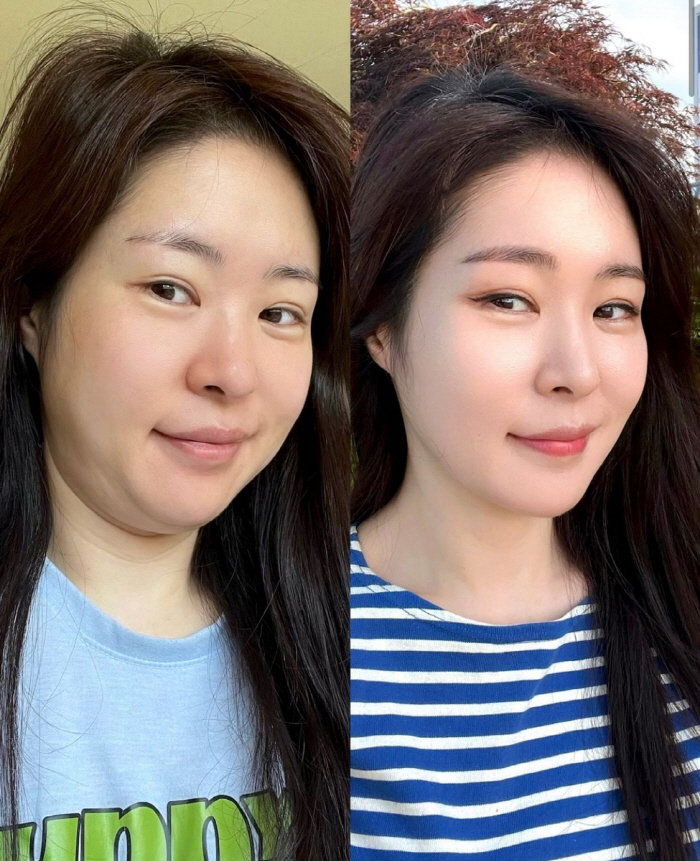 미자, 4일 만에 -3kg '급찐급빠' 성공 "쏙 들어간 배+슬림한 허리…
