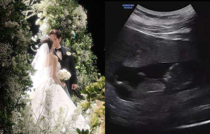 [공식]나윤권, 40대에 아빠 된다…결혼 3개월 만에 2세 소식