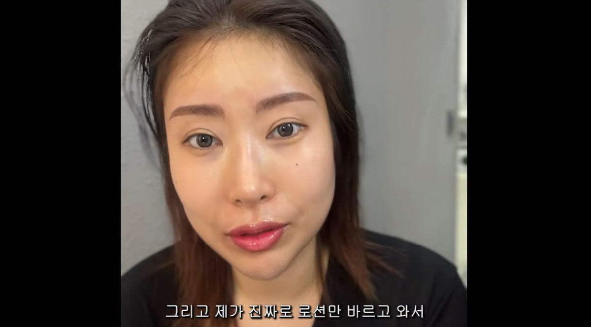 이세영 "얼굴 전체 성형..완벽한 이목구비 되고 싶었다" 대만족