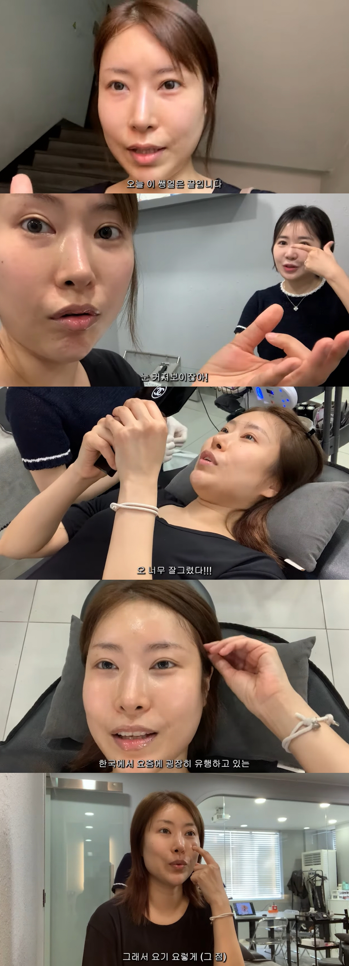 이세영 "얼굴 전체 성형..완벽한 이목구비 되고 싶었다" 대만족