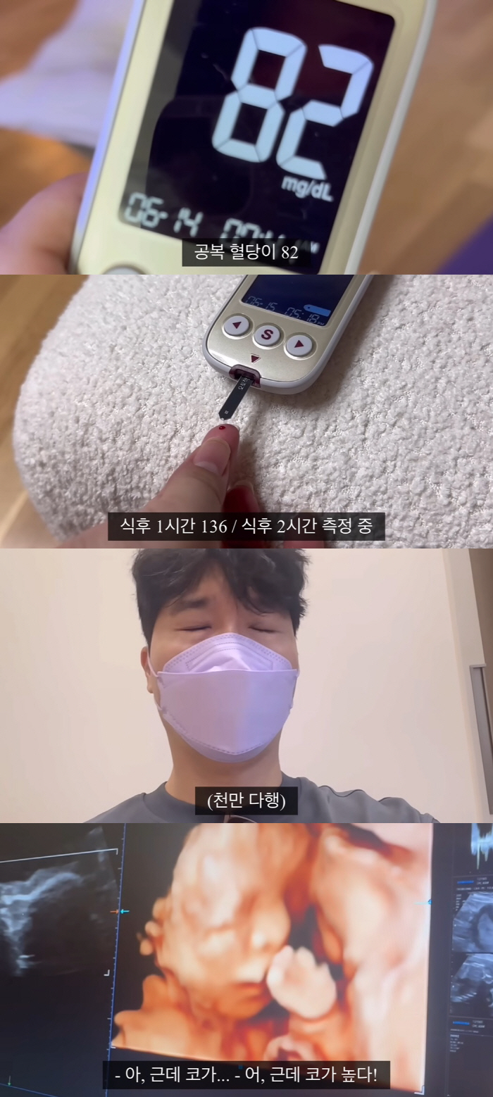 '박수홍♥' 김다예, 철저한 혈당 관리→초음파 사진에 깜짝 "전복이 코가…