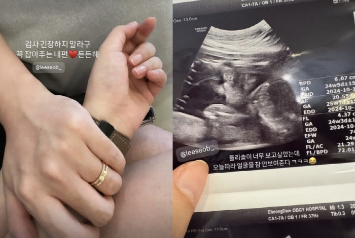 '심리섭♥' 배슬기, '임산부 배지'에 뭉클 "뭔가 자랑스럽고 감사해"