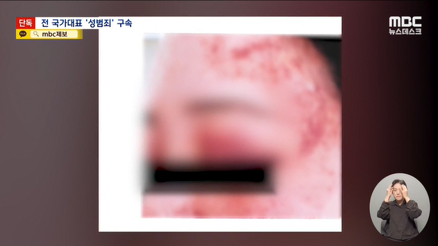 [종합] 럭비선수가 또? 전 럭비국가대표, 전 여친 강간 상해로 구속