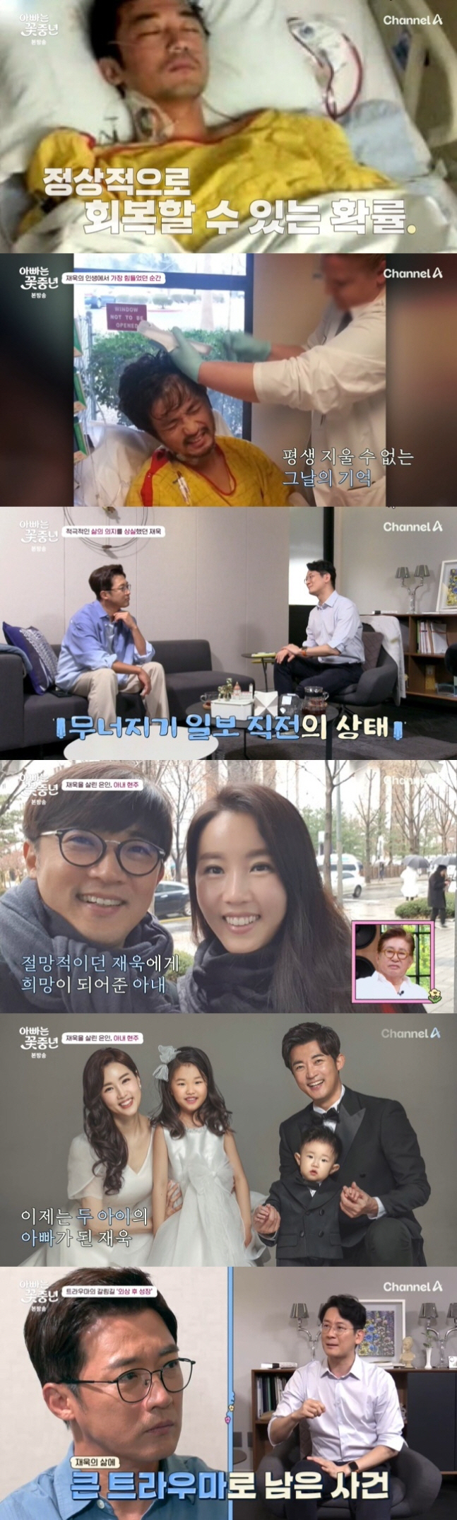 안재욱, 머리 절반 연 뇌수술 트라우마 "수술비만 5억+회복 확률 7%"…