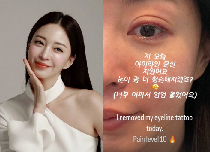 "아파서 울어" 한예슬, 아이라인 문신 제거 실시간 공개