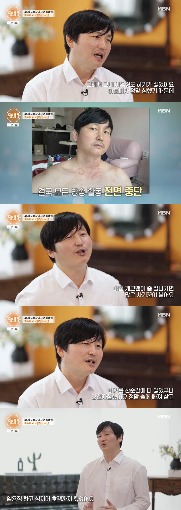 김대범 "얼굴 덮은 아토피+주식으로 전재산 잃어" 전성기 때 잠적한 이유 ('특종세상')[종합]