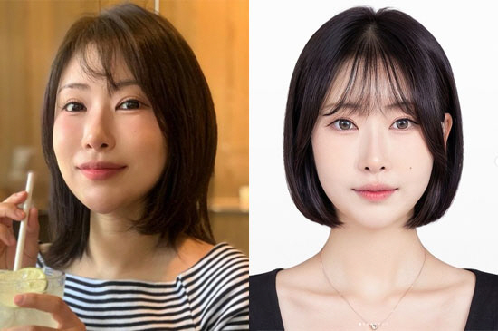 이세영, 얼굴 전체 성형 후 확 달라졌네 "면접 프리패스상 됐다"