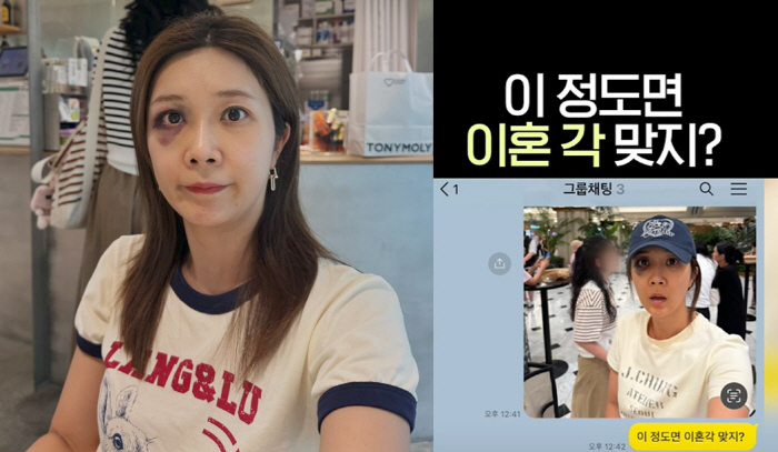 이정민, '멍든 눈'으로 "이혼각?" 장난→이혼 운운 댓글에 "단순 사고…