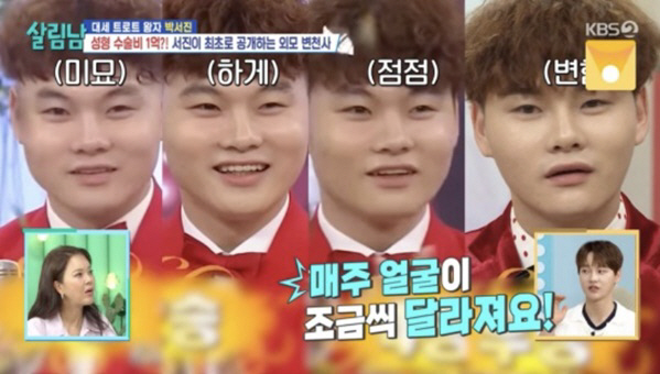 박서진, 성형수술에 1억 "코 1번·눈 3번..매주 얼굴 달라져" 고백 …
