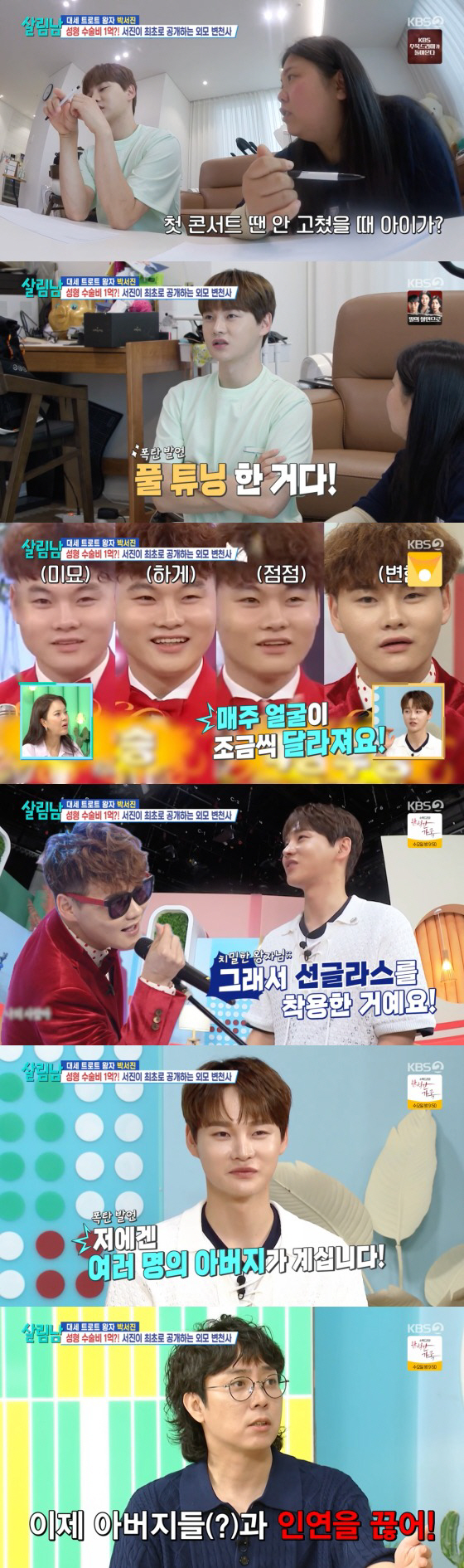 박서진, 성형수술에 1억 "코 1번·눈 3번..매주 얼굴 달라져" 고백 …