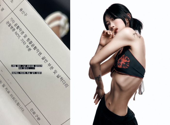 "49kg 감량" 故 최진실 딸 최준희, 심각한 몸상태…"염증아니고 괴사…