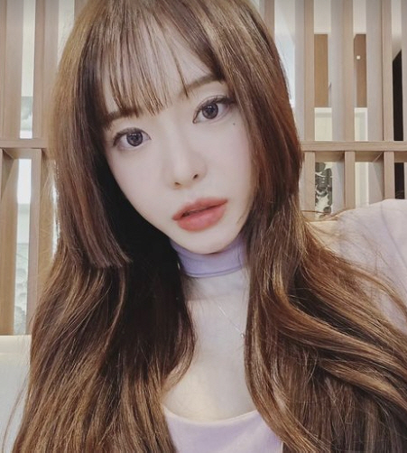 '이혼' 서유리, 생소한 '무릎 색소 치료' 고충 "암만 받아봤자 또 상…