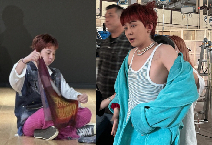 [SCin스타] 지드래곤, 할머니 패션에 꽂히더니…결국 부항자국 논란 '…