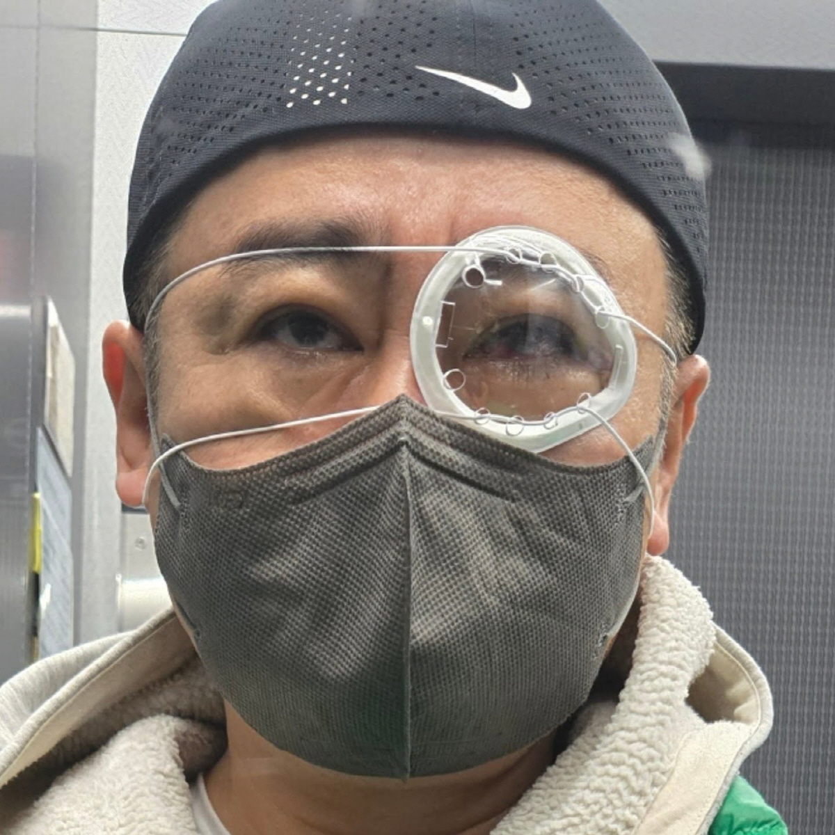 이광기, 돌연 휴식 선언했다..망막박리 수술 받은 '심각 근황'