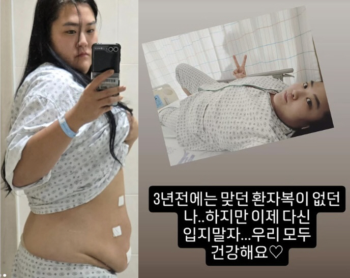 '150→99kg' 미나 시누이, 맞는 환자복도 없던 뚱뚱 과거 '충격'