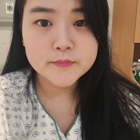 '150→99kg' 미나 시누이, 맞는 환자복도 없던 뚱뚱 과거 '충격'