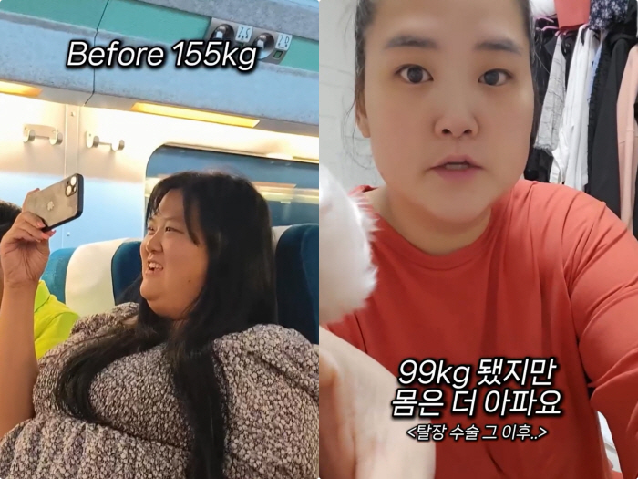 '150kg' 미나 시누이, 50kg 뺐어도 "99kg, 초고도비만..아…