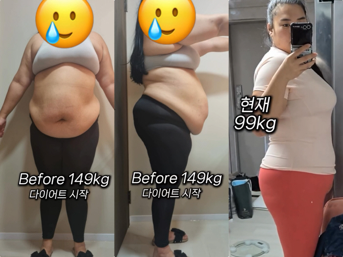 '150kg' 미나 시누이, 50kg 뺐어도 "99kg, 초고도비만..아…
