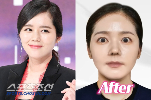 한가인, 왜 성형을..수술 후 얼굴 보니 충격 “턱·광대 3500만” (…