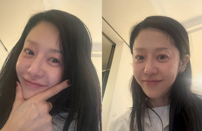 고현정, '흰머리+핼쑥한 얼굴' 근황...큰 수술 후 촬영장 복귀