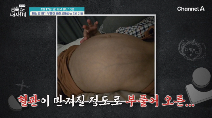 밤마다 배가 풍선처럼 부풀어..7세 금쪽이, 원인불명 고통에 응급실까지(…