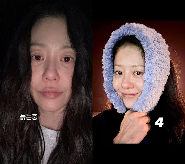 "늙는 중" 고현정, 큰 수술 후 야윈 얼굴..주름 드러낸 민낯