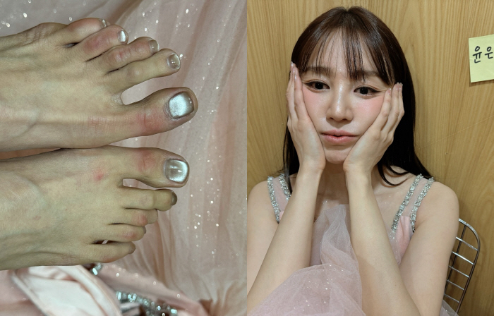 [SCin스타] “발 퉁퉁 붓고 새벽 3시 첫 끼, 너구리 먹고 뻗어” …