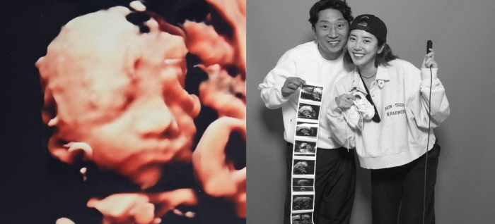 손담비, 2세 딸 입체 초음파 속 또렷 콧날...♥이규혁 "제발 엄마 닮…