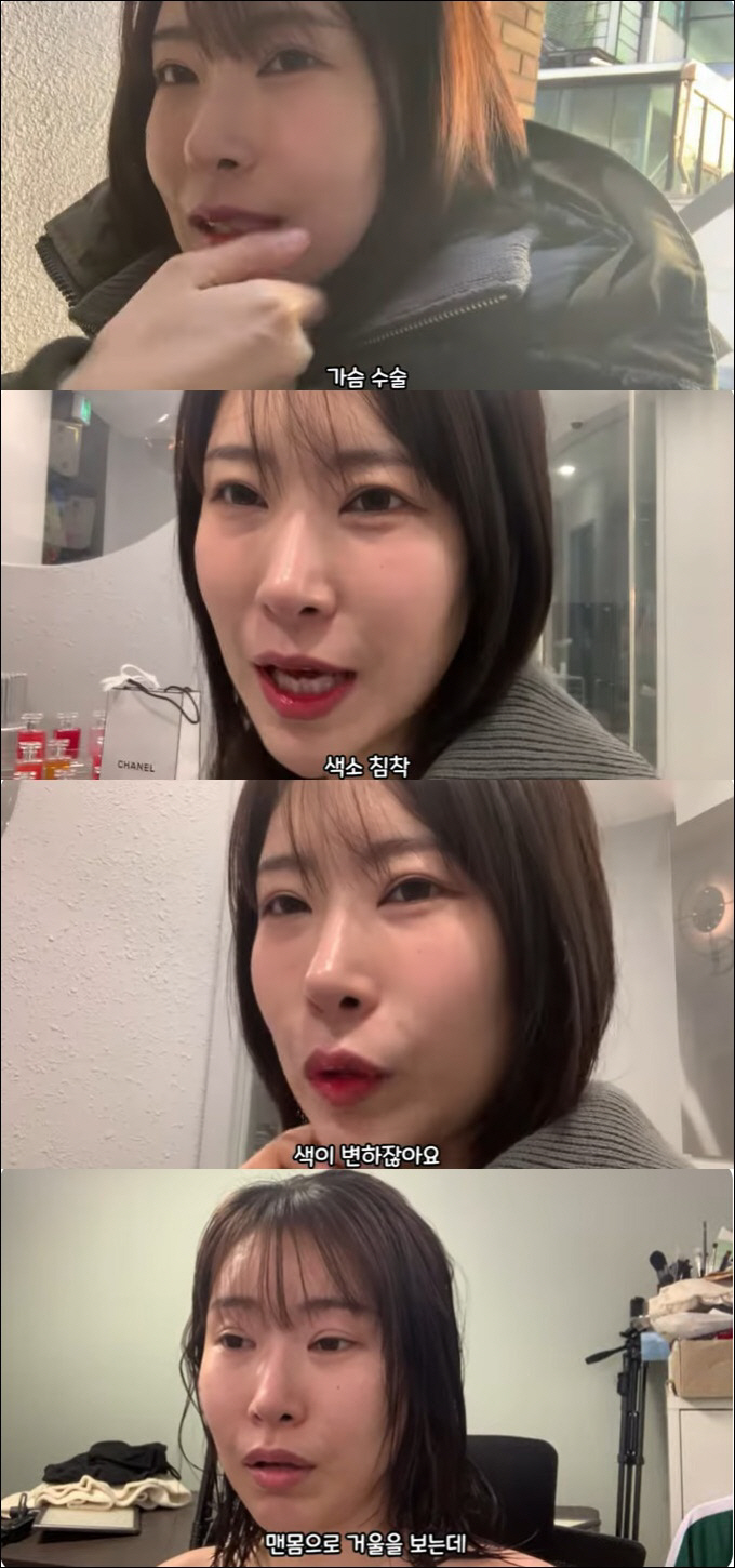이세영, '월수익 천' 찍고 가슴 수술 감행 "색 마음에 안 들어 유륜 …