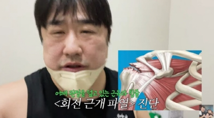 [SC리뷰] "왼팔 작살났다" 8개월 아빠 된 강재준, 회전근개 파열 '…