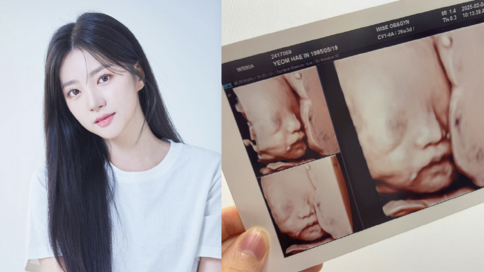 라붐 해인, 벌써 두 아이 엄마라니...둘째 입체초음파 자랑 "너무 활발…