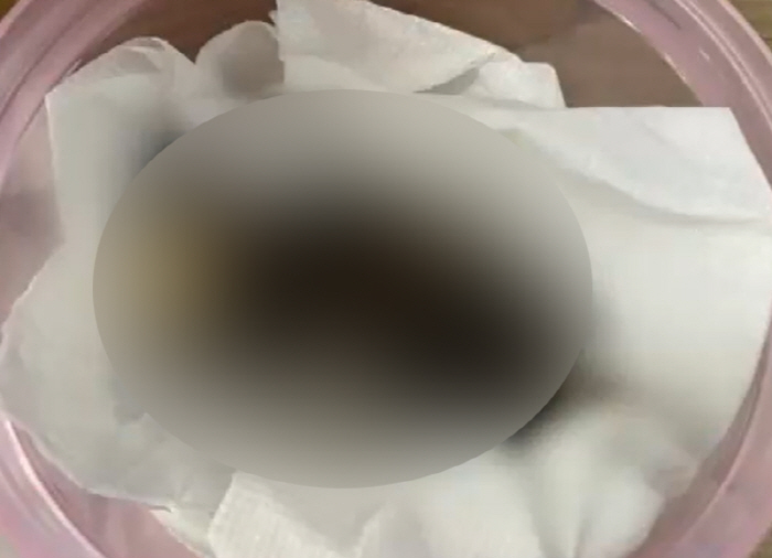 건조한 영아 사체 2구 택배로 팔려다 '덜미'…구입 이유는?