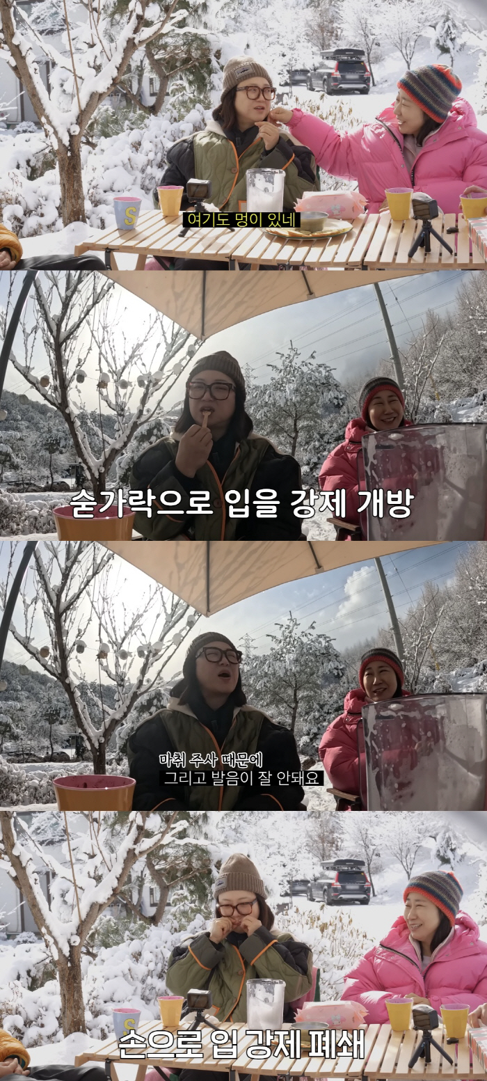 김숙, 시술받은 얼굴 마비수준 "숟가락으로 입 강제 개방, 광대는 트럭에…