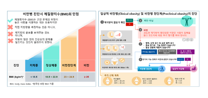 "비만병 진단, BMI만으론 부족" 새 진단 기준 제시