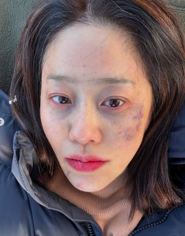 [SCin스타] 흰 머리+멍투성이 된 고현정, 무슨 일? "늦잠 자고파"