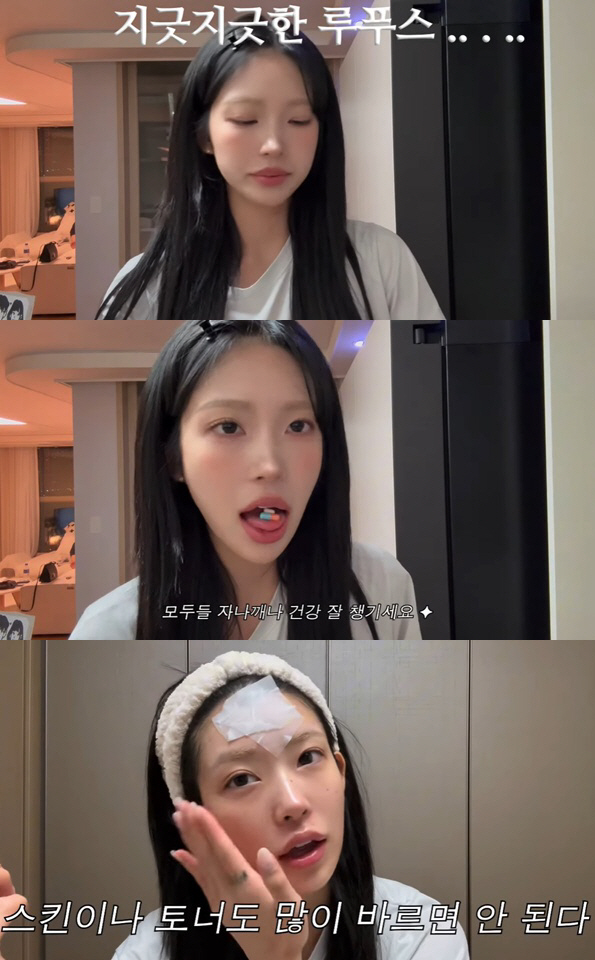 '최진실 딸' 최준희, 47kg 감량해도..루프스병ing "지긋지긋"