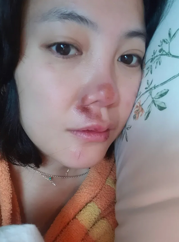 고은아, 낙상사고 이어 또 안타까운 소식…친언니 절도 피해 고백 ('방가…