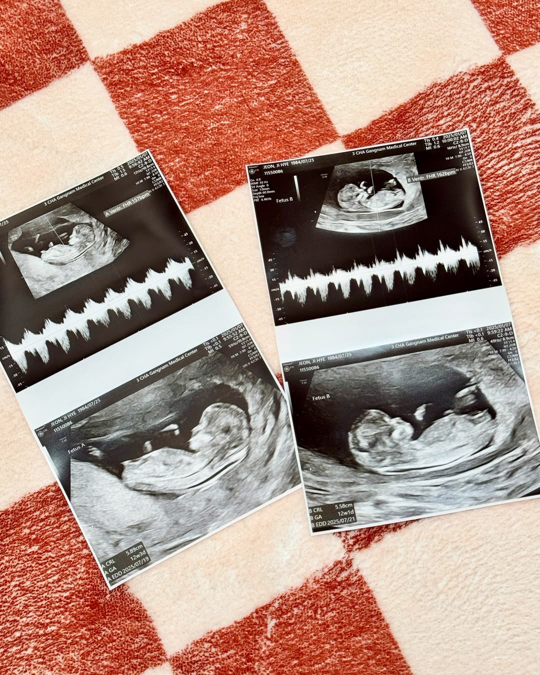 '쌍둥이 임신' 레이디 제인, 살짝 드러난 'D라인'...♥임현태와 발리…