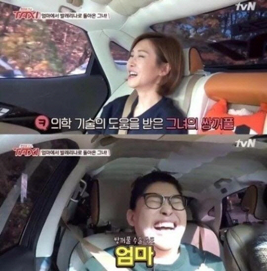 '엄태웅♥' 윤혜진 "어릴때 한 성형 다 망해..안면거상술 고민"