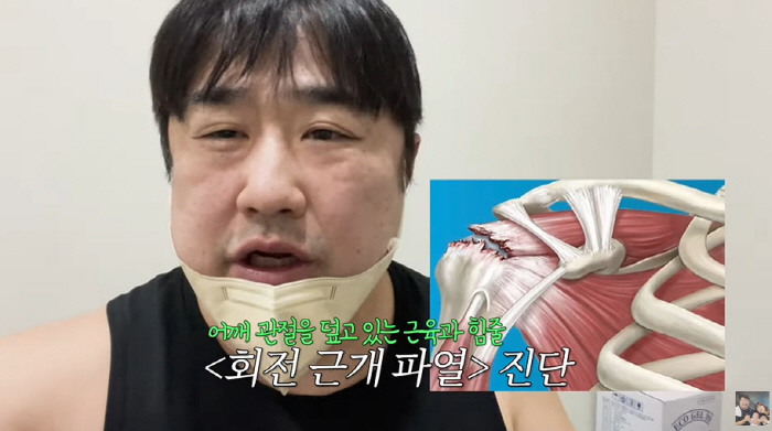 "어깨 작살났다"던 강재준, 결국 子 위해 왼팔 포기...8kg 子 안고…