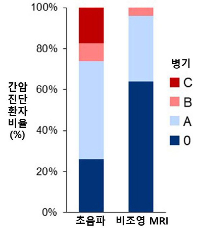 "비조영 MRI, 간암 조기 진단율 96%…초음파 대비 22%p 높아"