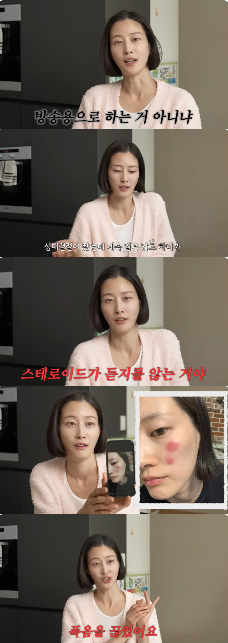 이현이, 희귀난치병 이어 건강 적신호 고백 "스테로이드도 안 들어"
