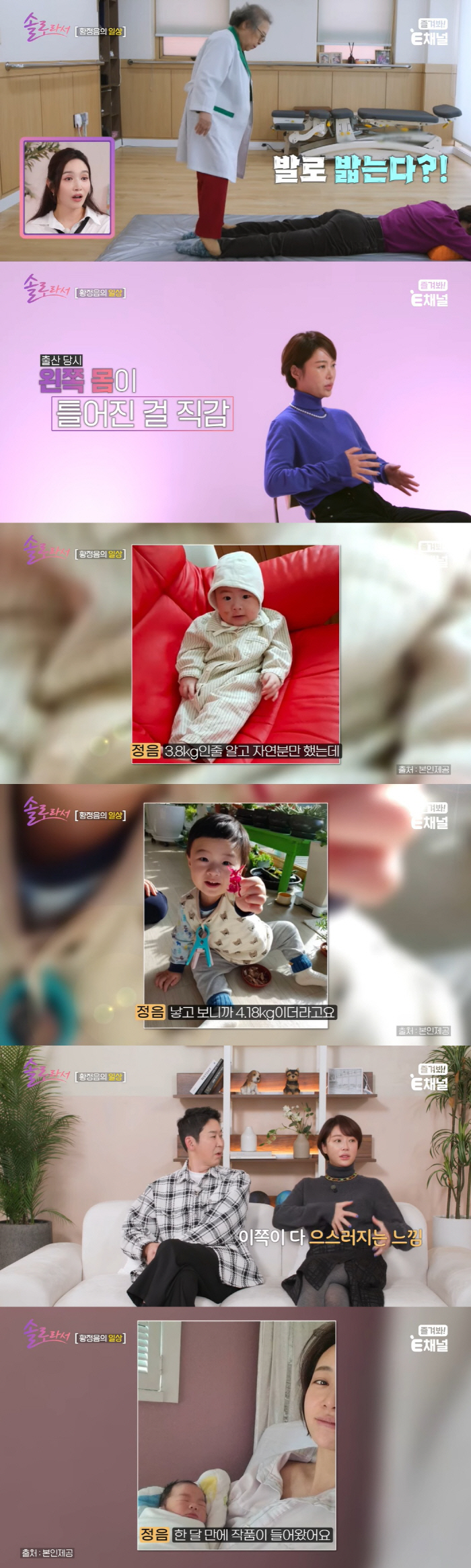 황정음, 4kg 우량아 자연분만 후유증 7년째 "몸 으스러져" ('솔로라…