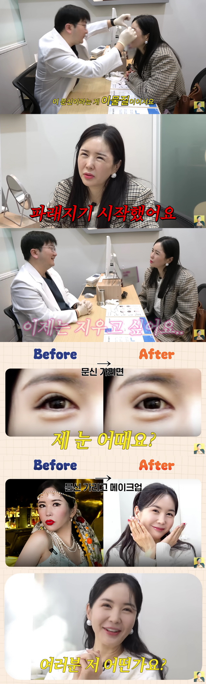 '눈수술 4번' 장영란, 남편 몰래 또 성형상담.."아줌마같은 쌩얼 스트레스"('A급 장영란')[종합]