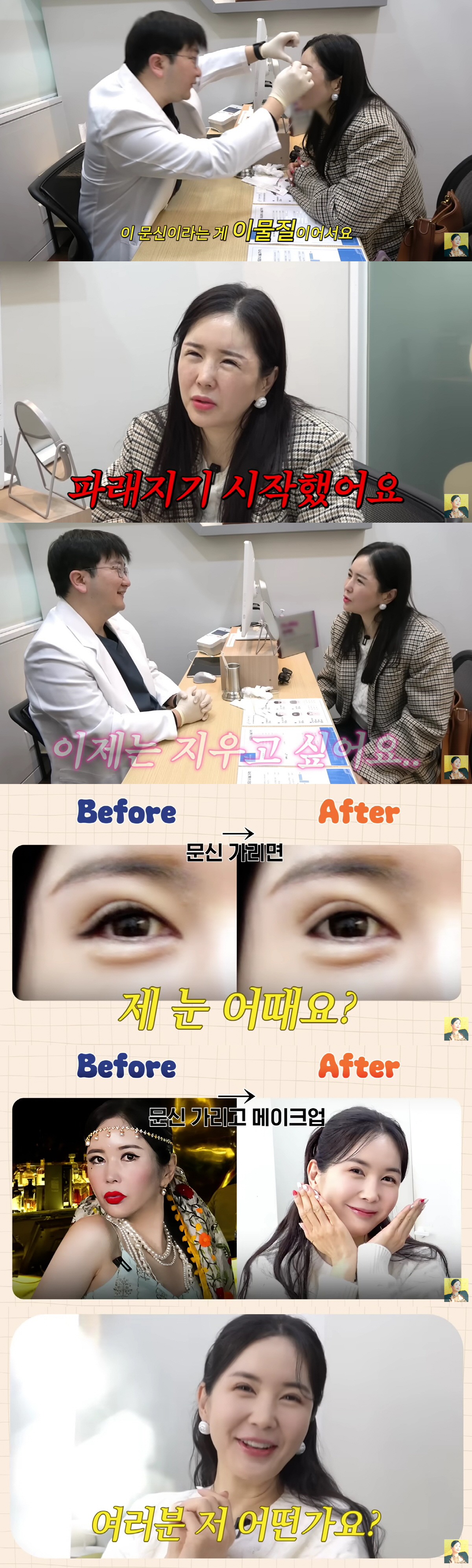 '눈수술 4번' 장영란, 남편 몰래 또 성형상담.."아줌마같은 쌩얼 스트…