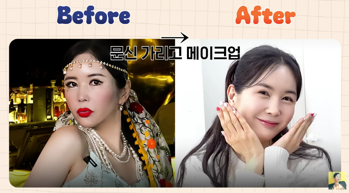 '눈수술 4번' 장영란, 남편 몰래 또 성형상담.."아줌마같은 쌩얼 스트…